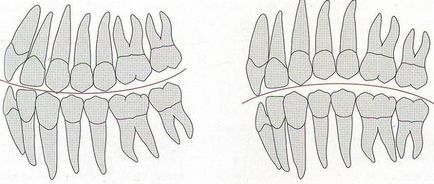Крива Шпеє в ортодонтії сагиттальная і трансверзального окклюзионная дуга