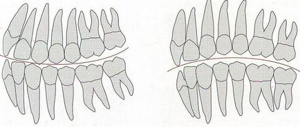 A görbe a Spee a fogszabályozás szagittális és transzverzális okklúziós ív