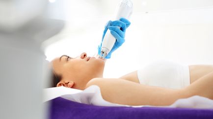 Laser peeling pe fata la Moscova, preturi, comentarii despre clinici