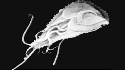 Giardia при деца, което детето има Глардиаза, снимки паразити