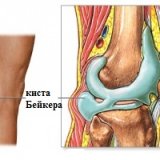Народні способи лікування кісти Бейкера - ваш доктор айболит