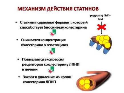 Очищення судин від холестеринових бляшок ефективні способи, uflebologa