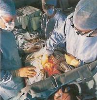 Операція на серці з пересадки судини (лікування - кардіологія)