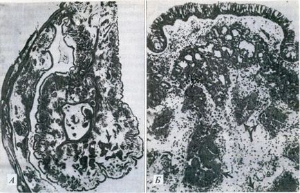 Organul mirosului - nasul - sistemele corpului (histologie)