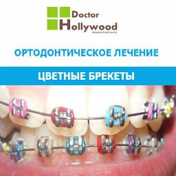 Fogszabályozás Moszkva hogy fogszabályozó a fogak, harapás korrekciója, tedd fogszabályozó ára Moszkvában