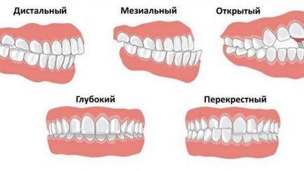 Albirea dintilor, stomatologie, ortodontie