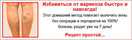 Набряки ніг при варикозі причини, фото, лікування