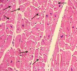 Dystrofii parenchimatoase - practici histologiști