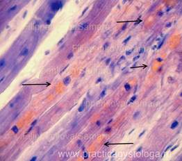 Dystrofii parenchimatoase - practici histologiști