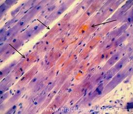 Dystrofii parenchimatoase - practici histologiști