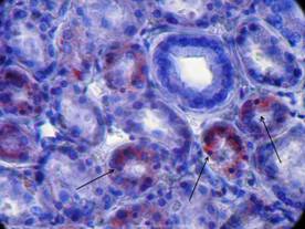 Dystrofii parenchimatoase - practici histologiști