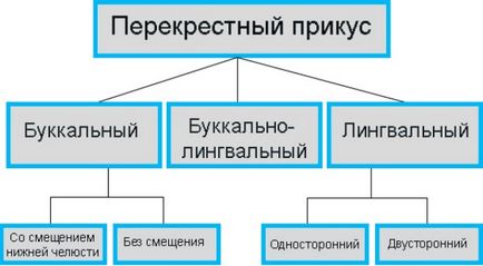 Перехресний прикус у дітей і дорослих класифікація, методи виправлення