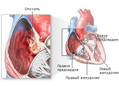 Чому люди товстіють від фаст-фуду