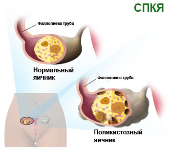 Чому люди товстіють від фаст-фуду