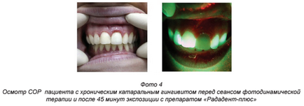 Societatea Profesională a igienistilor din Rusia dentară - tehnologie rusă AFS -