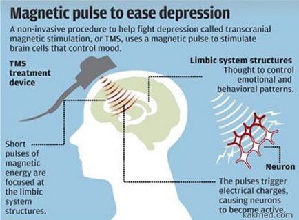 Pszichotronikus fegyverek „tolta ki a pszichiátria antidepresszánsok