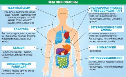 Cancerul de stomac - simptome, cauze de dezvoltare, diagnosticul de cancer de stomac, tratamentul cancerului de stomac și