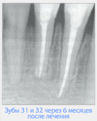 Diagnosticul cu raze X pentru bolile dinților și fălcilor