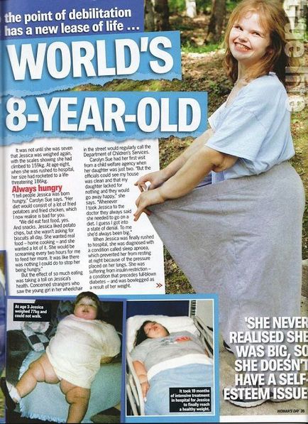 Cel mai gros copil din lume și pierdere în greutate de victorie de 140 kg, umkra