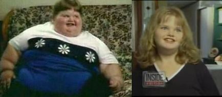Legkövérebb gyerek a világon, és megnyerte a fogyás 140 kg, umkra