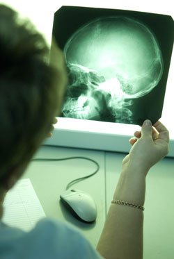 Pentru a face o sarcină roentgen în clinica din Scandinavia, radiografia din Sankt Petersburg