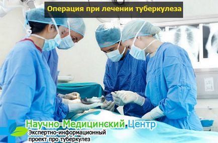 Mennyi gyógyítható a tuberkulózis (TBC) Hogyan kezeljük a tuberkulózis