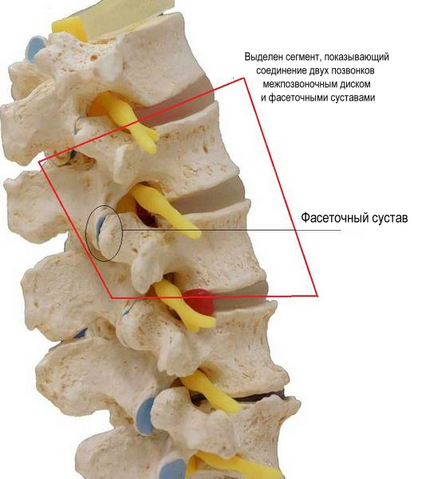Spondilartroza coloanei vertebrale - simptome, diagnostic și tratament - clinică martie