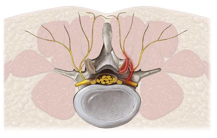 Spondilartroza coloanei vertebrale - simptome, diagnostic și tratament - clinică martie