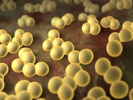 Staphylococcus aureus - simptome la adulți și copii, fotografii în gât și gât