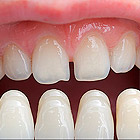 Fogászat „Dent 32” - multidiszciplináris fogászati ​​klinika Moszkvában széles körű szolgáltatásokat,