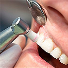 Стоматологія «32 дент» - багатопрофільна стоматологічна клініка в Москві широкий вибір послуг,