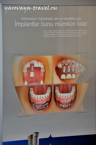 Стоматологія в Туреччині моя зубна фея езгі Озкан, подорожі з Іриною ярої