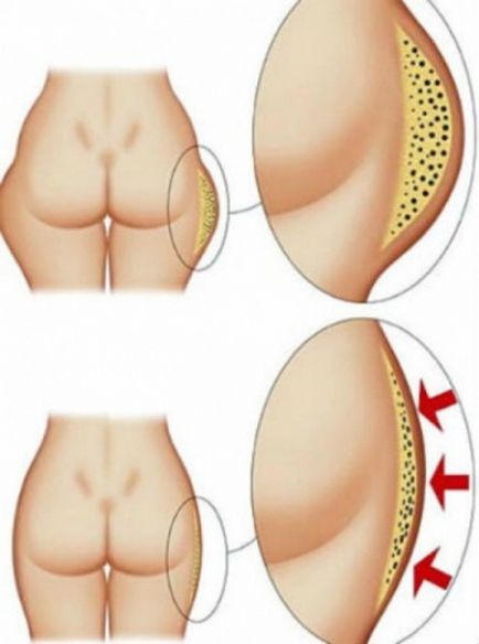 Urechile de pe coapse sunt exerciții eficiente care vă vor ajuta să scăpați de (video)