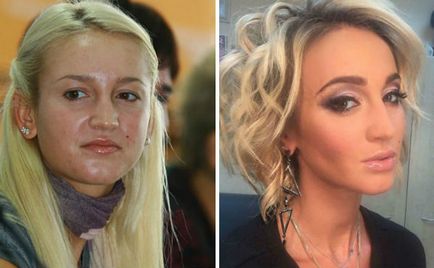 Провідна Ольга Бузова до і після операцій з пластики (фото)