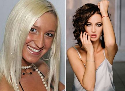 Conducerea Olga Buzova înainte și după chirurgia plastică (foto)