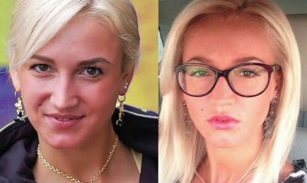 Conducerea Olga Buzova înainte și după chirurgia plastică (foto)