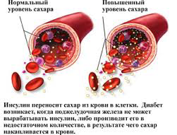 Високий цукор в крові причини, ознаки і профілактика