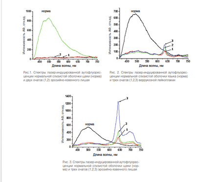 Posibilitățile de spectroscopie de autofluorescență în detectarea bolilor precanceroase ale mucoasei