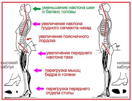 Шкода високих каблуків