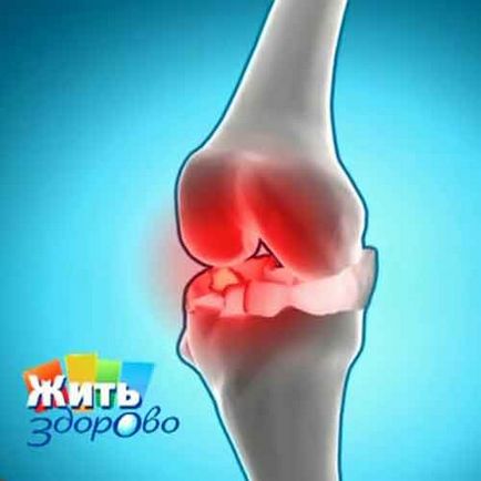 Osteoartrita articulației genunchiului, despre starea de sănătate cu un copil mic