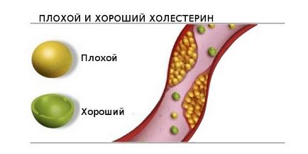 Атероклефіт біо інструкція із застосування, ціна, аналоги, відгуки