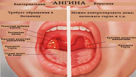 Чим полоскати горло, якщо болить