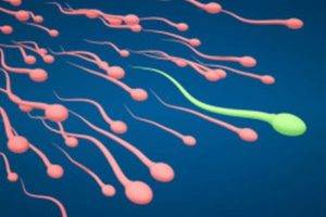 Що таке некрозооспермія або некроспермія, чи можна завагітніти при некроспермії