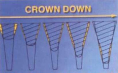 Crown down методика (від коронки вниз)