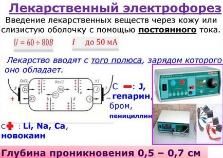 Деформуючий спондилоартроз поперекового відділу - лікування захворювання