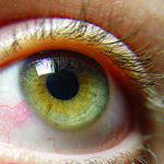 Dirofilariasis în simptomele umane și tratamentul ocular