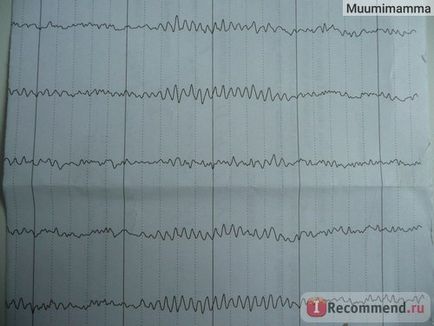 Electroencefalografia (EEG) - 