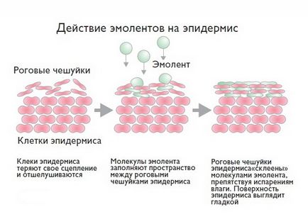 Емоленти при атопічний дерматит у дітей список, назви