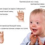 Галлюциноз і його лікування, галюциноз - лікування, симптоми, причини, розвиток на тлі алкоголізму,