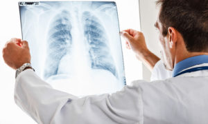 Pleurisia purulentă a simptomelor pulmonare, tratamentul, consecințele